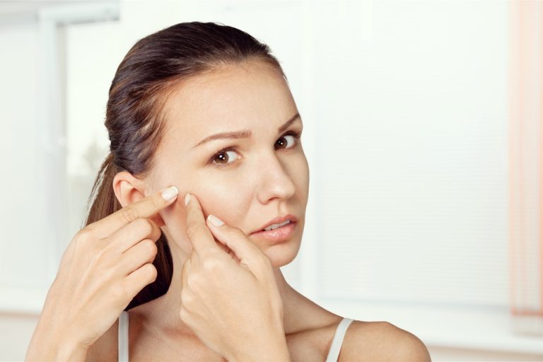 acne-visage